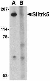 Slitrk5 Peptide