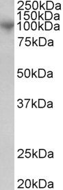 ADAM8 Antibody