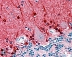 Amphiphysin Antibody