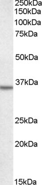 Annexin Antibody