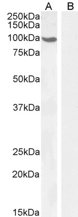 Androgen Receptor Antibody