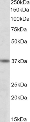 ATF4 Antibody