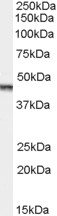 Aurora Kinase Antibody