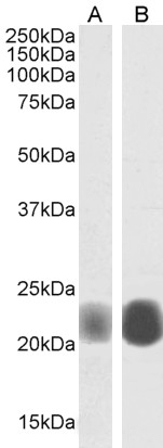 Caveolin-1 Antibody
