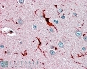 Glutathione Peroxidase 1 Antibody