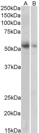 VMAT2 Antibody