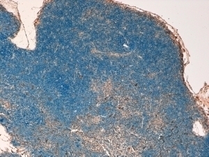STAT3 Antibody