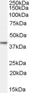 Vitamin D Receptor Antibody
