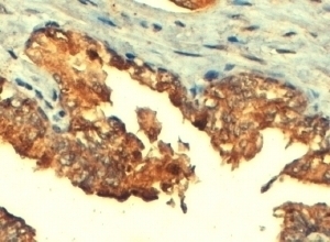 ABCC4 Antibody