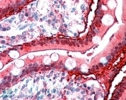 ACACB Antibody