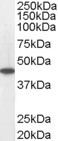 ACADM Antibody