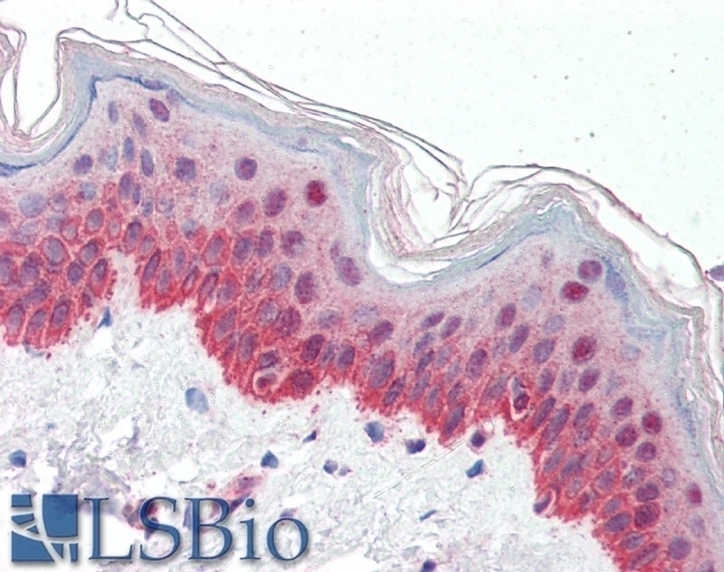 ACOX2 Antibody