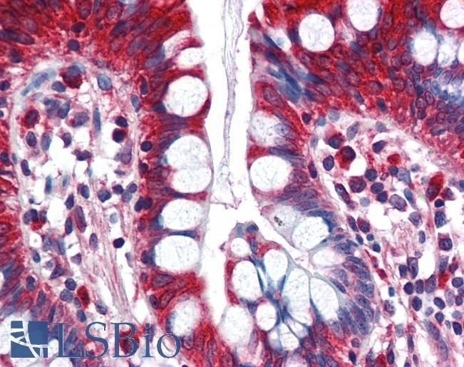 ACSL5 Antibody