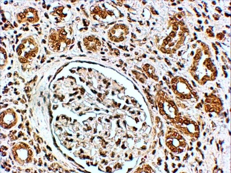 ADRB2 Antibody