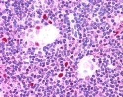 AIRE Antibody