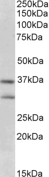AIRE Antibody