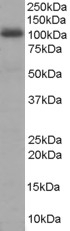 AKAP95 Antibody