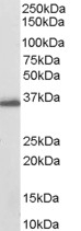 AKR1C3 Antibody