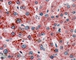 AKR1C4 Antibody