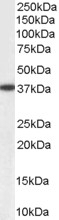 Aldehyde Reductase Antibody