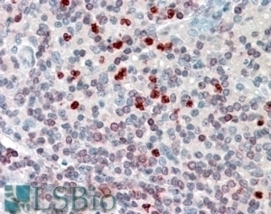 ALOX5AP Antibody