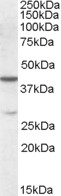 Alpha2-antiplasmin Antibody