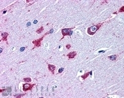 ALS2 Antibody