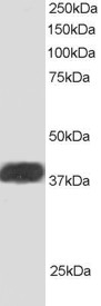 ALS2CR1 Antibody