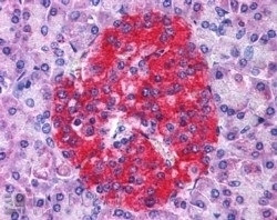 Annexin A10 Antibody