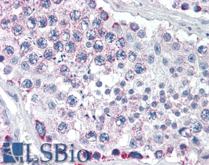 AOC3 Antibody