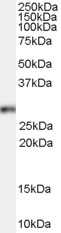 Arachidonate 5-lipoxygenase Antibody