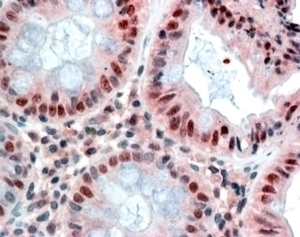 ARF1 Antibody