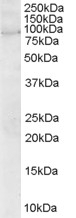 ARHGEF4 Antibody