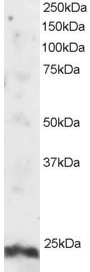 ARL4A Antibody