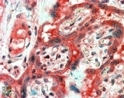 ARMET Antibody