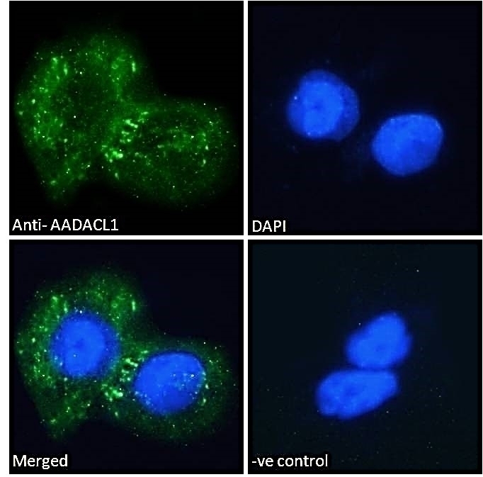 Aromatase Antibody