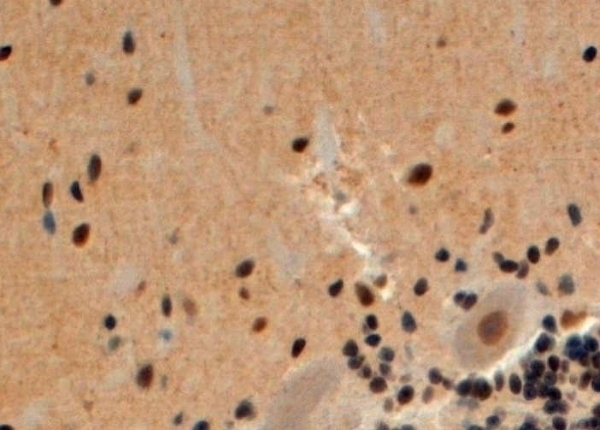 Arrestin Antibody