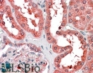 AS3MT Antibody