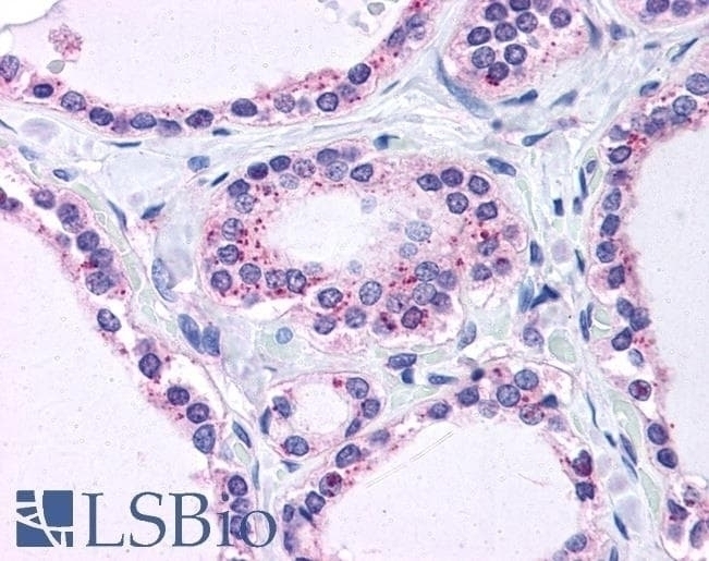 ASF1A Antibody