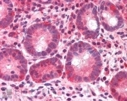 BAZ2B Antibody