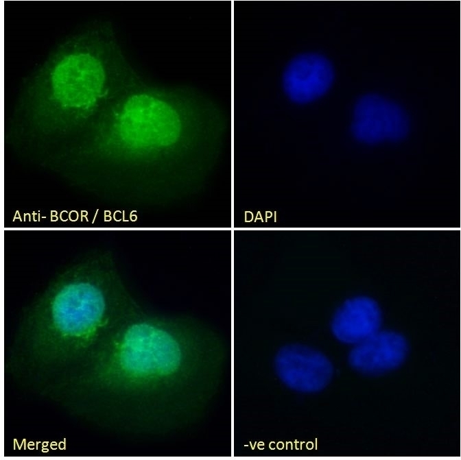 BCOR Antibody