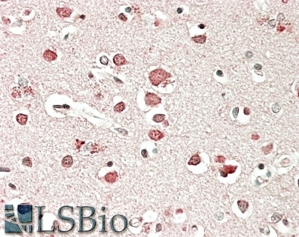 Biglycan Preproprotein Antibody