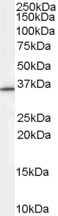 BMPR1A Antibody