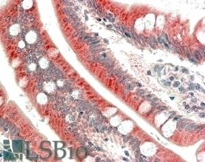 BNIP1 Antibody