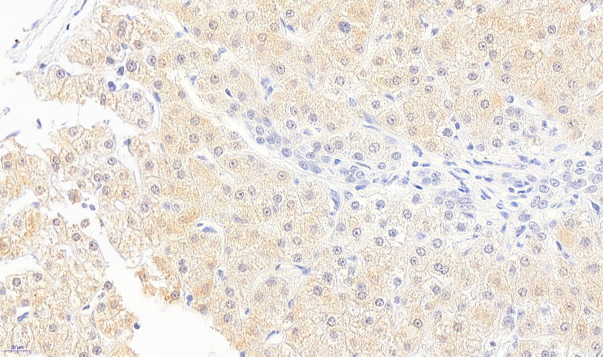 Bradykinin Receptor B1 Antibody