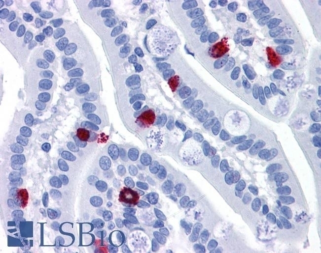 Cathepsin K Antibody