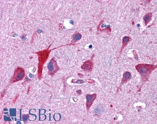 D54 Maintenance D54 Antibody - Cat. No. 45-455 | ProSci