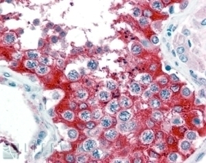 G6PD Antibody