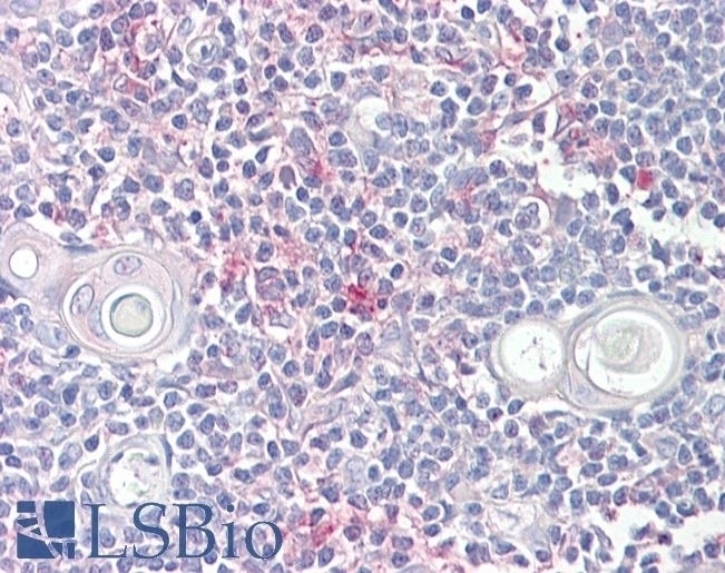 Neurofibromin 2 Antibody