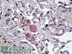 Neuropeptide Y Receptor Y5 Antibody